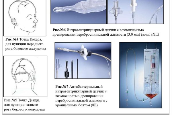 Где найти рабочую ссылку на кракен